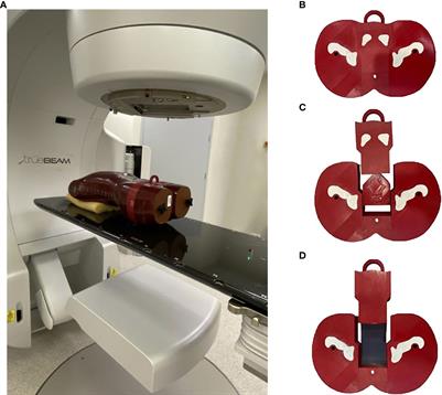 Radiotherapy planning in a prostate cancer phantom model with intraprostatic dominant lesions using stereotactic body radiotherapy with volumetric modulated arcs and a simultaneous integrated boost